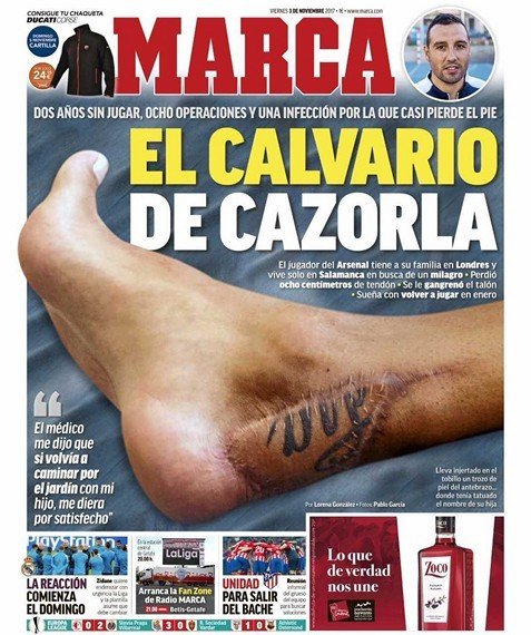 Касорла не дал "Реалу" победить. Ещё несколько месяцев назад ему могли ампутировать ногу